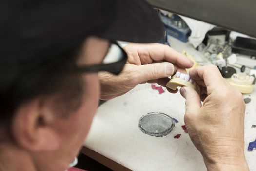 Male Dental Technician Working On A 3D Printed Mold For Tooth Implants In The Lab.