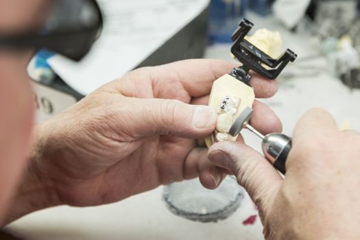 Male Dental Technician Working On A 3D Printed Mold For Tooth Implants In The Lab.