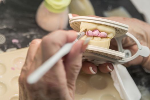 Female Dental Technician Applying Porcelain To A 3D Printed Implant Mold In The Lab.