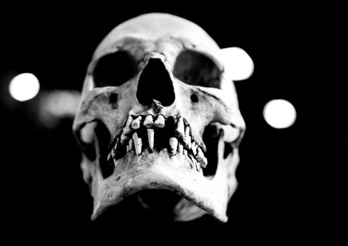 Fiberglass human skull missing teeth on a black background