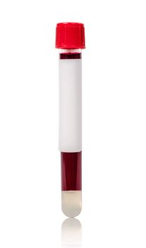 Red vacuum blood tube test with sample blood for Medical laboratory isolated on white background, clipping path.