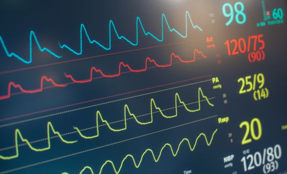 A hospital monitor with heart rate, pulse and respiratory data.