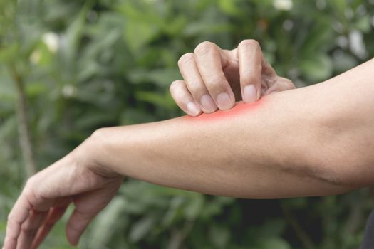 Women scratch itch with hand. Woman scratching her arm healthcare concept.