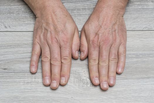 The back of a man's hands resting on a table side by side