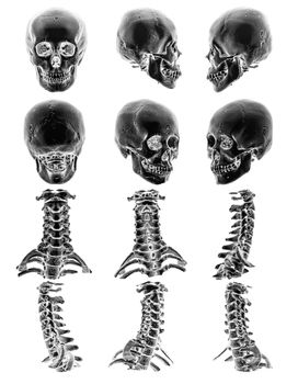 CT scan ( Computed tomography ) with 3D graphic show normal human skull and cervical spine . Multiple view .