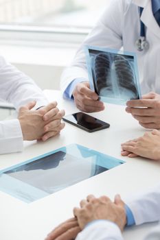 Group of doctors look and discuss x-ray in a clinic or hospital