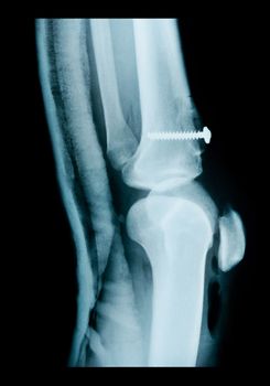 X ray photo of human knee.