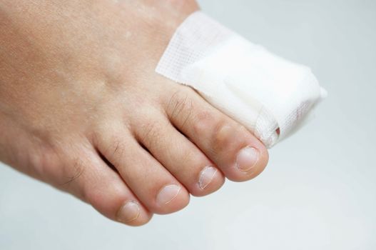 Big toe nail wounded by gauze dressing and dry skin on white backgrouond.