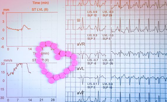 EKG or ECG (Electrocardiogram) graph report paper. EST ( Exercise Stress Test ) result and pink heart shape made from pills. Package promotion for heart check up in senior or elderly people concept.