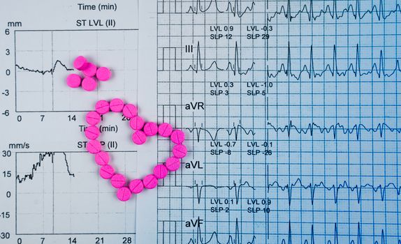 EKG or ECG (Electrocardiogram) graph report paper. EST ( Exercise Stress Test ) result and pink heart shape made from pills. Package promotion for heart check up in senior or elderly people concept.