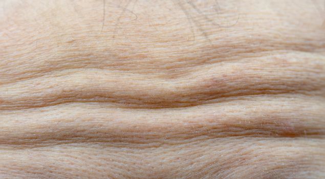 Macro shot detail of forehead wrinkles from emotional expression. Collagen and botox face injections concept. Dry forehead of face skin of menopause woman