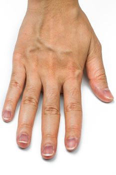 Woman hand with blood veins isolated on white background. Finger with mid-digital hair is dominant gene. Back of hand skin with dry and wrinkle in adult woman need spa or paraffin wax treatment.