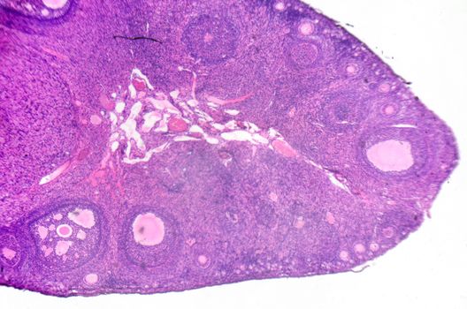 micrograph of ovary showing primordial, primary and secondary follicles isolated on white background.