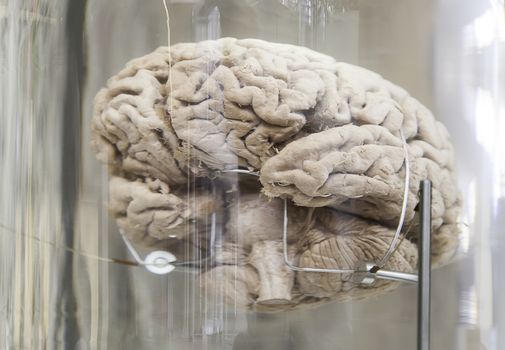 Human brain, detail of a human organ, intelligence and thought