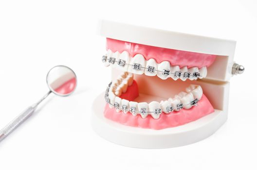 tooth model with metal wire dental braces and mirror dental equipment isolated on white background.