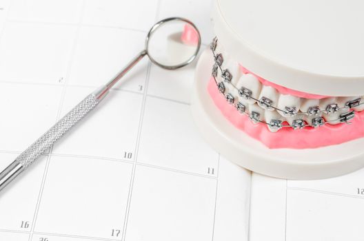 Tooth model with metal wire dental braces on a calendar. Regular checkups are essential to oral health