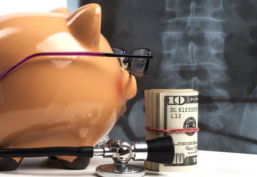 Piggy Bank With Black Stethoscope and Dollar Banknotes Roll viewing Xray Isolated on White Background