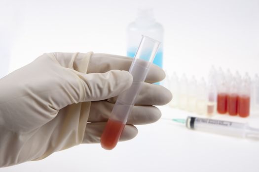 hand with latex glofes examining blood sample in a plastic tube 