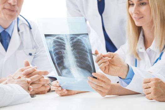 Group of doctors look and discuss chest x-ray in a clinic or hospital