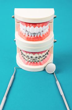 Compare tooth model and tooth model with metal wire dental braces and equipment on blue background.
