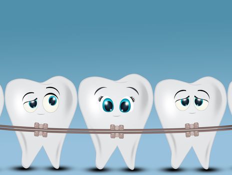 illustration of dental braces