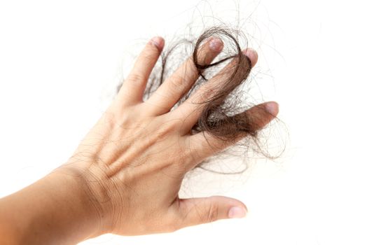 Human hand with lost hair on it, isolated on white background.