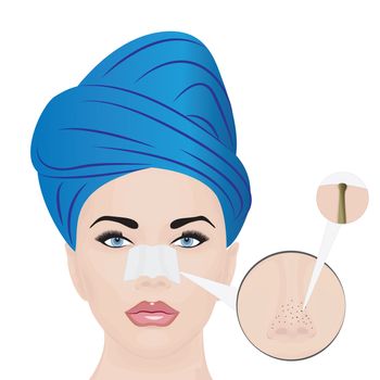 Treatment Blackheads on Nose vector illustration showing skin problems