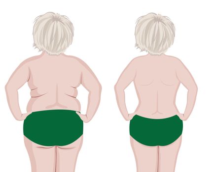 Fat and slim girl back. before and after reshaping vector illustration