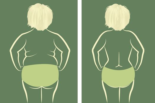 Fat and slim girl back. before and after reshaping vector illustration