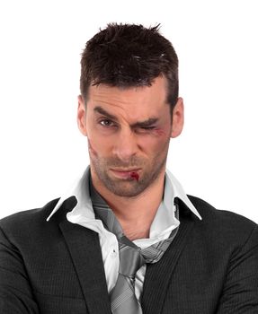 Close up of a businessman with bloody lip, beaten and bruised, isolated