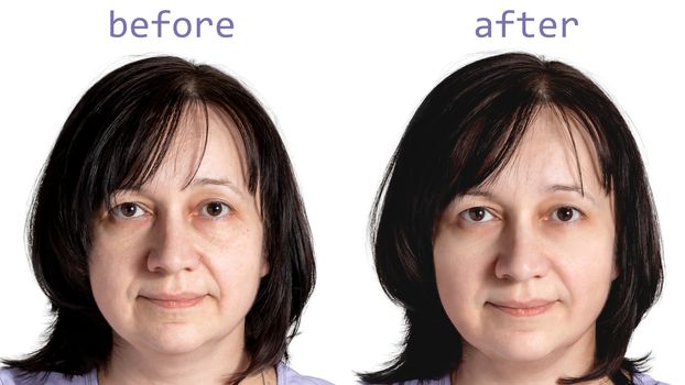 Face of a mature woman with dark hair before and after cosmetic rejuvenating procedures, isolated on white background.