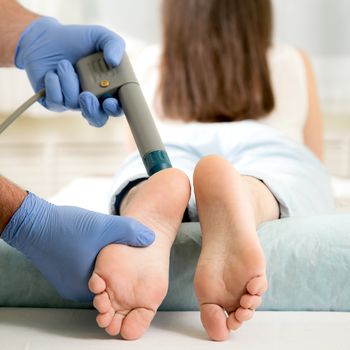 Extracorporeal Shock Wave Therapy For Plantar Fasciitis. Treatment of calcaneal spurs.