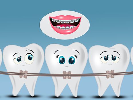 illustration of orthodontics teeth or dental braces