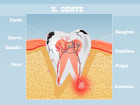 illustration of the tooth scheme