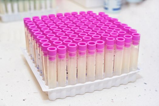 empty blood testing tube in laboratory