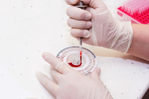 doctor hands working at laboratory. Blood test.