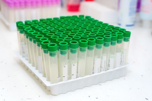 empty blood testing tube in laboratory