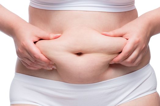 women's hands crumple fat on a fat belly, close-up shot in underwear