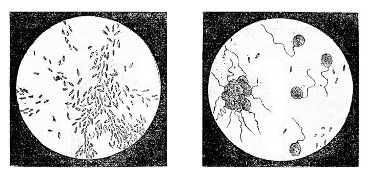 Fig 2. A bacterium (Bacterium termo), Fig 3. monads (Monas lens) Uvelles (Uvella Socialis), magnified 500 times, vintage engraved illustration. Magasin Pittoresque 1873.
