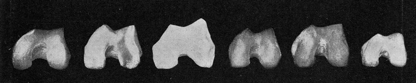 Comparative table of the surface of the knee joint of the femur of a European, an Australian, the Neanderthal man, an Australian, an African negro and a negro dwarf, vintage engraved illustration. From the Universe and Humanity, 1910.
