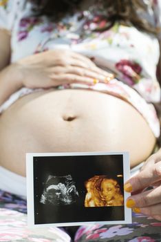 Pregnant women hold picture of womb. Daylight in the garden