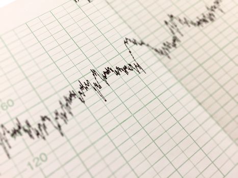 Printing of cardiogram report, electrocardiography, close-up