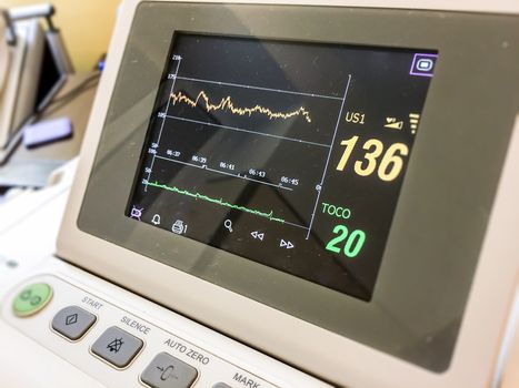 screen monitor measuring cardiac rate in a hospital