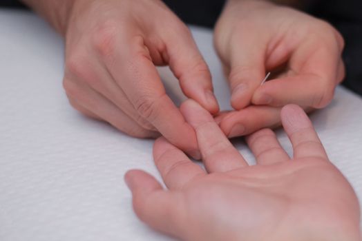 Body care , stimulating an acupuncture needle on the hand of a patient.Acupuncture, is used to relieve pain or for medicinal purposes. The benefits of acupuncture.