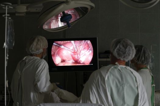 Doctors in the operating room do laparoscopy.The operation of internal organs of man.Profession surgeon