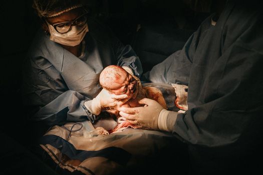 The medical team performing cesarean sections. The doctor hold the baby giving birth to his mother to see. This image was taken at AIIMS hospital, New Delhi, on March 2015.