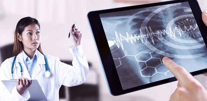 Asian doctor pointing with pen against bright white room with windows