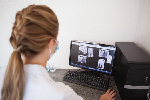 Dental assistant looking at x-rays on computer at the dental clinic