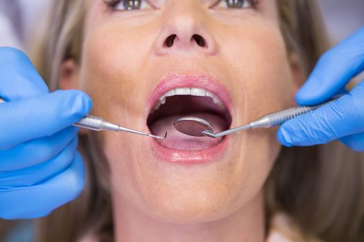 Close up of dentist examining patient at medical clinic