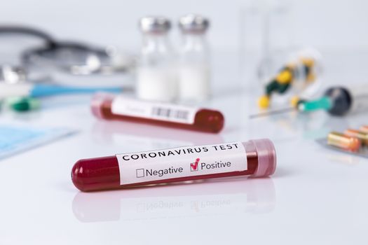 Blood test tube with the Coronavirus disease for virus test and research. Blood test tube with protective masks, medicines, thermometer, stethoscope and syringe on a white background.